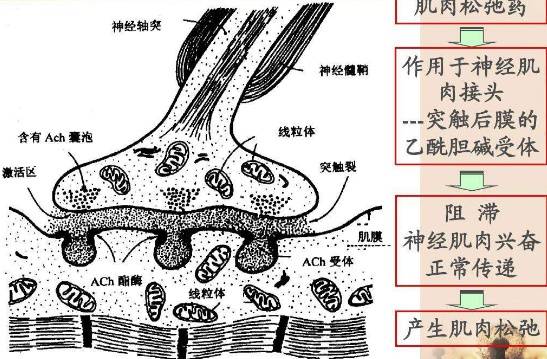 手术时全身麻醉后人是怎样醒过来的为什么有的人身体没有知觉
