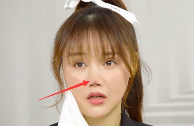 演员高溜整容失败首现身,多次修复鼻尖仍红肿,全程带口罩采访_腾讯