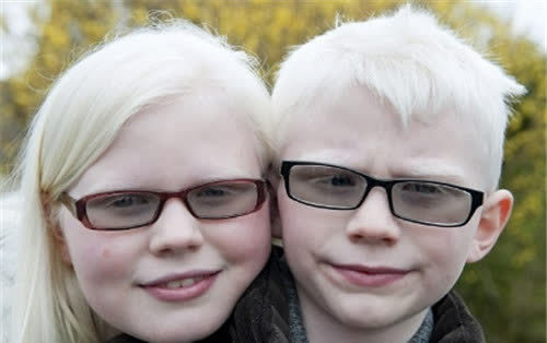 世界尊贵的蓝种人生活在6000米的高山上100多年仅露面了一次