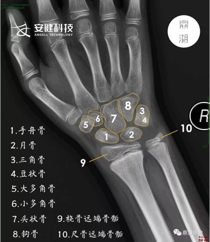 x线高清图谱精致腕关节解剖