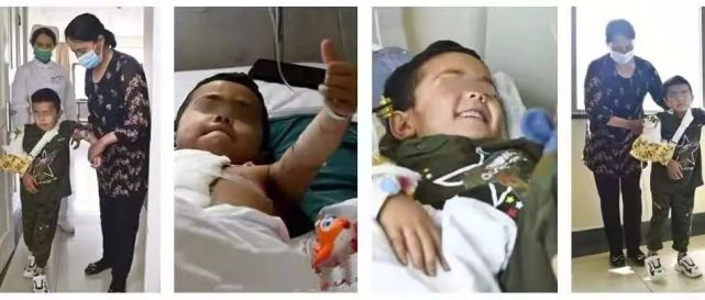 和田断臂再植男孩下地行走了