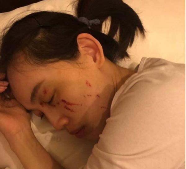 申明中详述了马蓉受伤的整个过程,和王宝强家暴自己的细节,言辞激烈