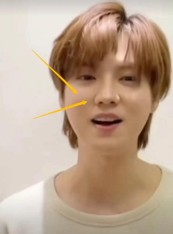 鹿晗发福惹争议硅胶脸加狗啃刘海网友还以为是李宇春