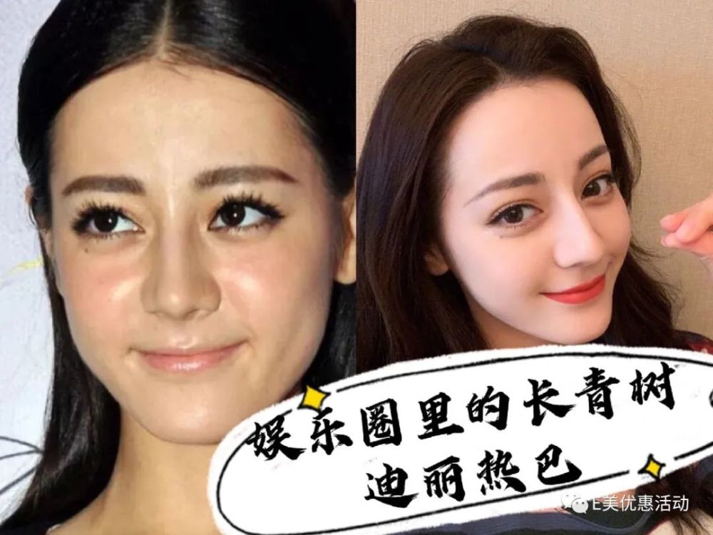 迪丽热巴是真真正正的整容模版到底是什么让她一直热度不断