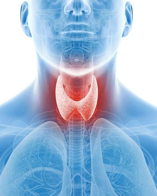 在早期无明显症状,一般无疼痛及压痛,衡量甲状腺异常与否的t3,t4早期