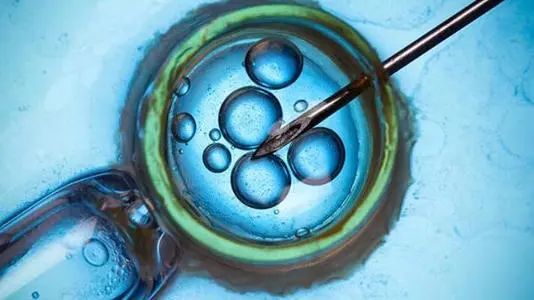 辅生医学科普试管婴儿促排取卵详细步骤及注意事项