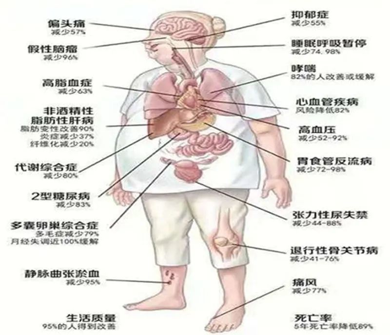 511世界防治肥胖日谁是你减肥路上的绊脚石