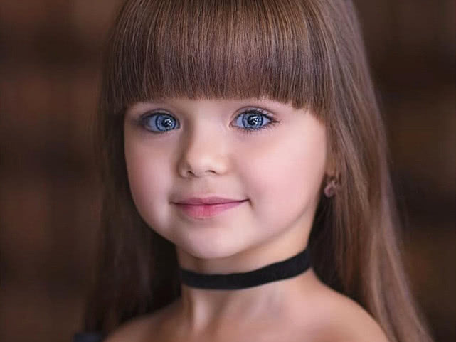 又称kabuki综合征,是一种罕见的疾病,于1981年由两位日本学者新川和