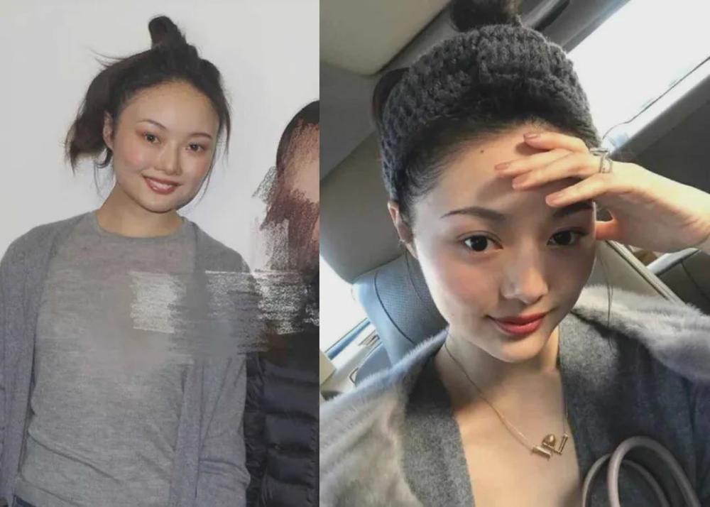 晚晚鼻头挛缩没钱修复?被艺术家爱上又毁掉的美人都长什么样