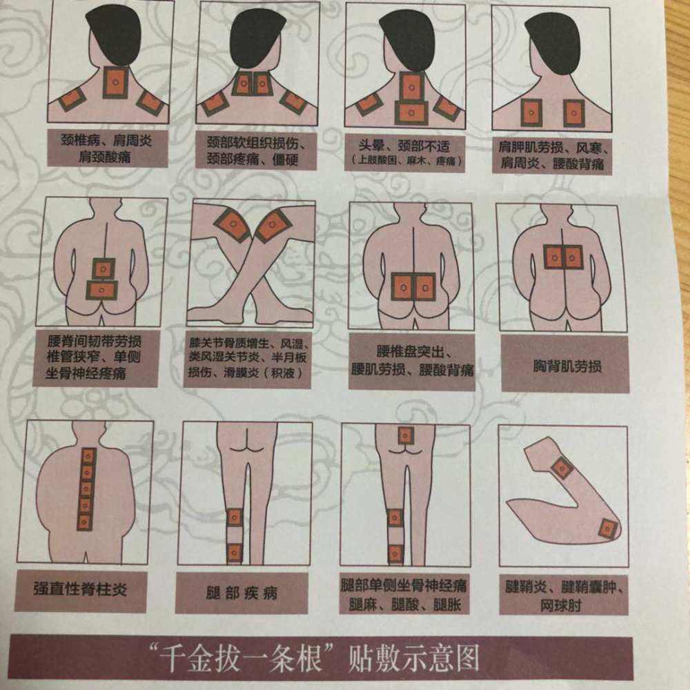 爆品返场,实力证明,家里必备,医用冷敷贴,一条根,哪里酸痛贴哪里!