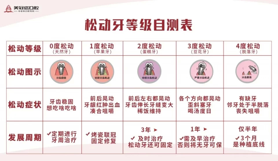 判断牙齿松动的程度牙齿松动一般是比较严重的牙龈萎缩造成的,其中