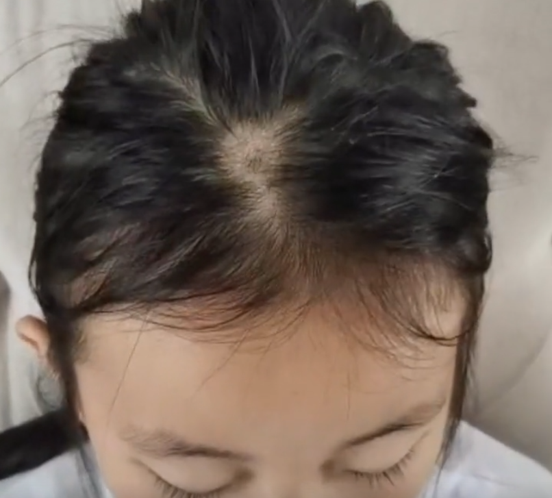 养了一只猫,10天后,猫咪让小主人变成了"秃头少女"