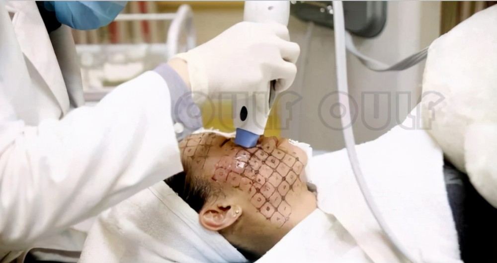 热玛吉起什么作用?一文讲清楚!