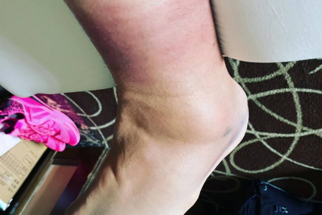 四消息李慕豪脚伤严重鲁吐自省虎头送祝福李敬宇试训北控