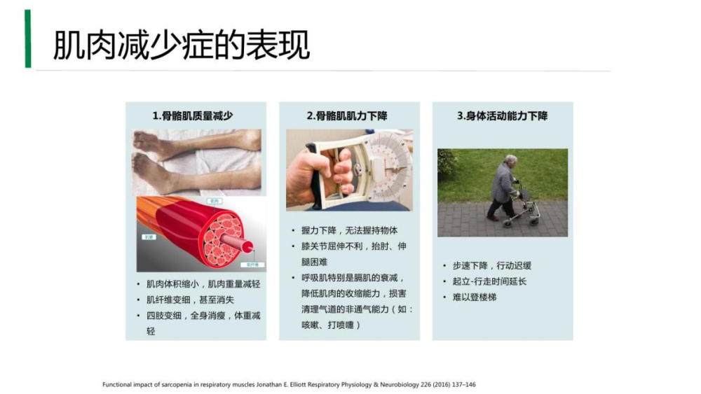 补充hmb,及时预防肌少症呵护中老年人肌肉健康_腾讯新闻