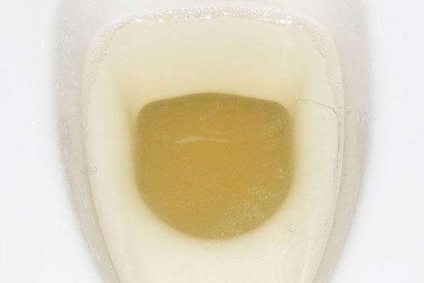 小便颜色很黄,气味很大,是怎么回事?情况可轻可重,别忽视