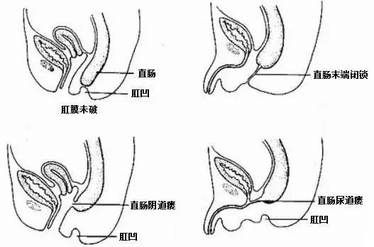 肛门六点位置图图片