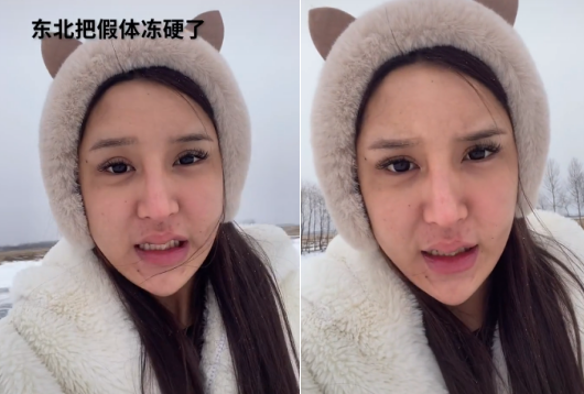 但讲真,不管是在娱乐圈从业,社交平台当网红,还是我们普通人,整容真的