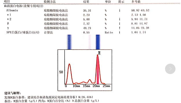 血清蛋白电泳:生化检测结果:医生回复目前已申请有关多发性骨髓瘤的