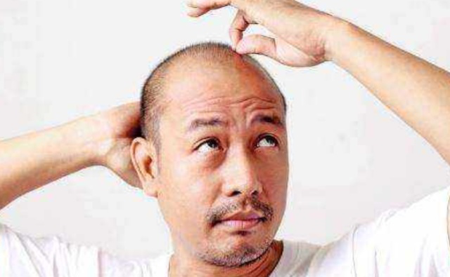 雄性激素旺盛的男人身上会有这些共性就算只占1个也很好