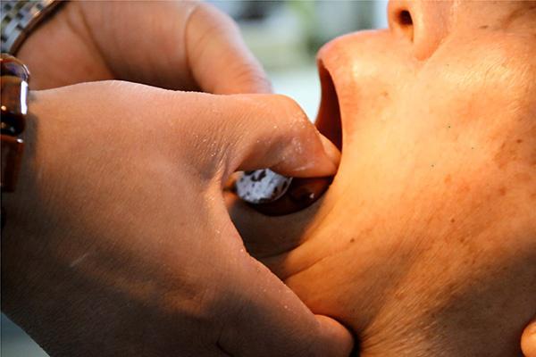 牙龈出血只是缺维生素c吗并不剩下的三个原因或许更关键