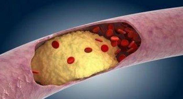 身体若出现这5个症状,可能说明血液已粘稠如粥了,勿大意了!