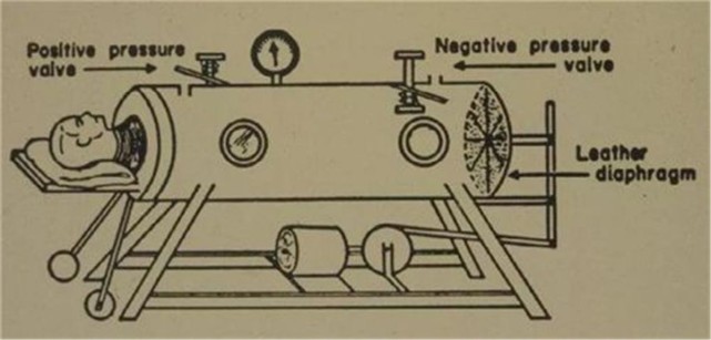 "铁肺"的工作原理很简单,将有呼吸麻痹的儿童密封在一个铁罐子里,然后