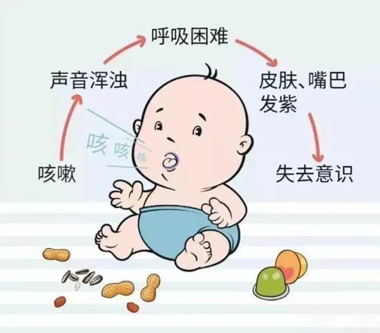 异物卡喉出现气道梗阻的表现