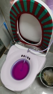 每日用温水或高锰酸钾溶液清洗外阴或坐浴治疗痔疮效果尤佳,这样可以