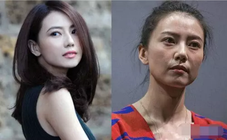 女明星生图曝光,暴露美容真相插图