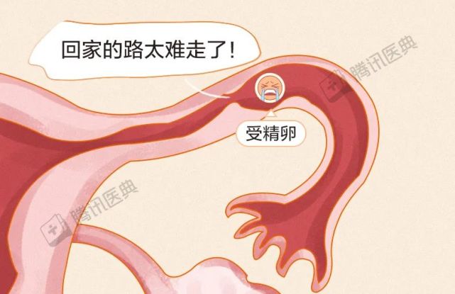 种植在卵巢或腹腔里,导致更为罕见和严重的"宫外孕"