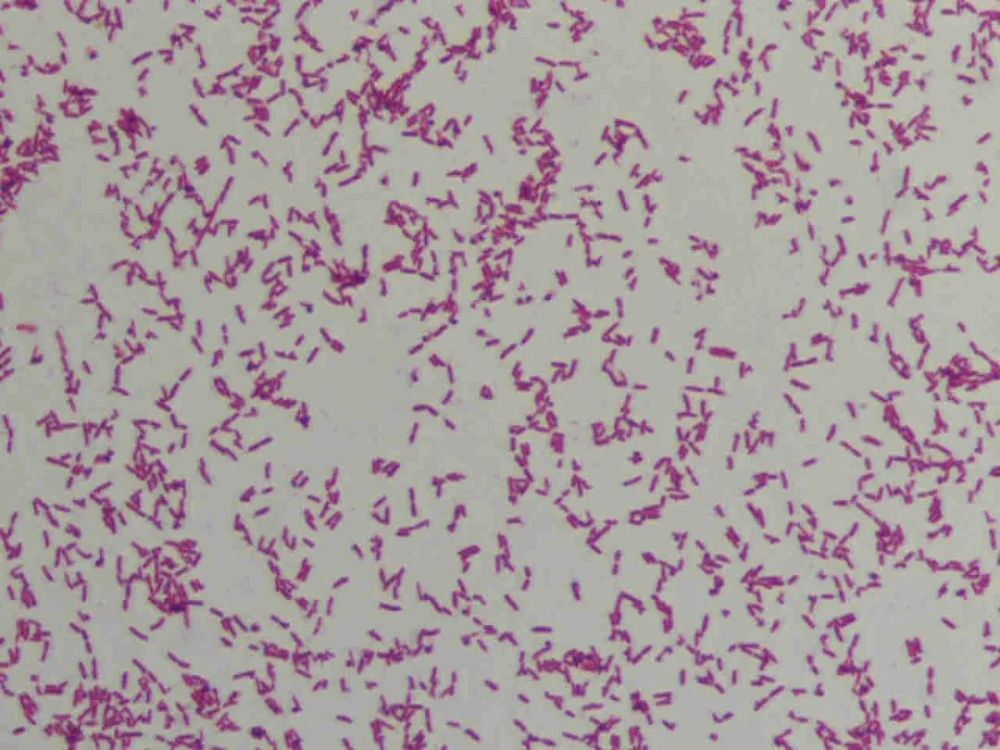 云南省境外输入类鼻疽伴头部脓肿1例|全国检验与临床思维案例_腾讯