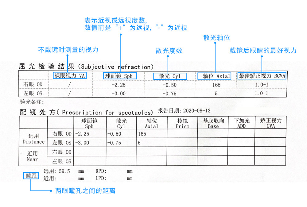 你看到验光单了可是你知道上面的参数都是什么意思吗