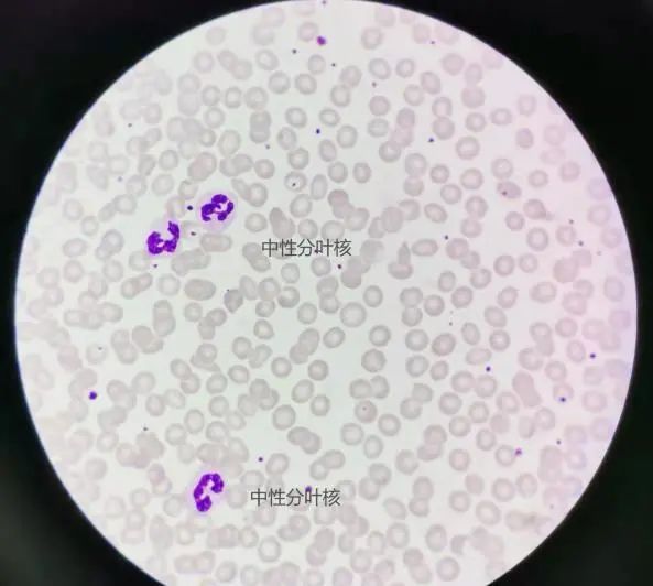 nrbc百分比高达上千你以为的真的是你以为的吗