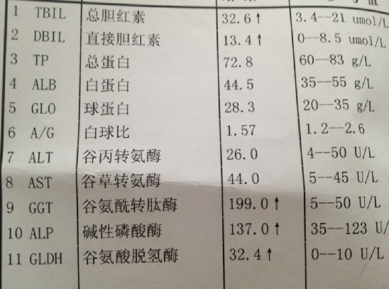 2,反映肝臟儲存功能的試驗血清總膽紅素,血清間接膽紅素,血清直接