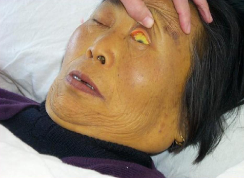 27岁女子新婚不久确诊肝癌2个月后离世丈夫面部早给提醒大意了