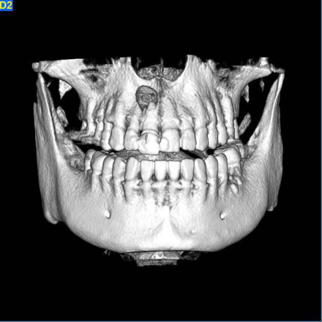 【口腔医院·专家团队】影像科