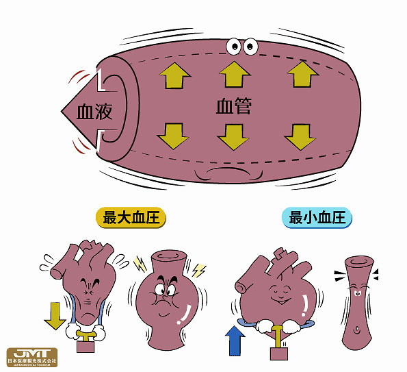 jmt日本醫療-要注意舒張壓偏高,通過每日測量捕捉異常|舒張壓|高血壓