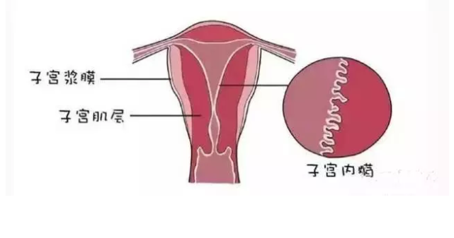 "渣男"说清宫后子宫内膜薄能恢复|子宫内膜薄|清宫|人流手术