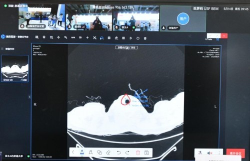 遠程診斷解決方案 助力醫療數智化轉型-智醫療網