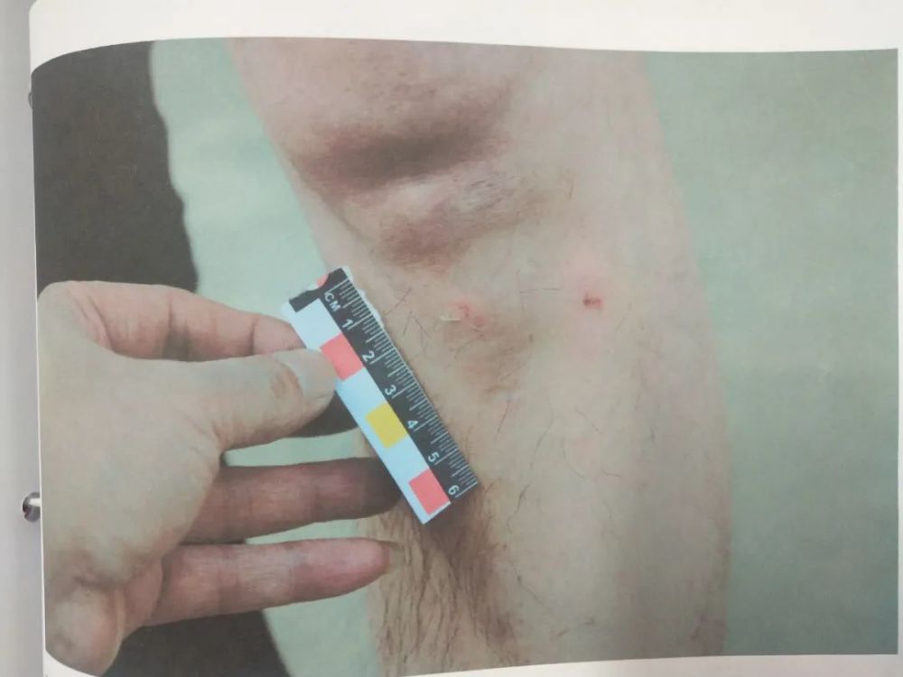 大闹村委换届现场,谩骂,打伤警察,贺州一男子获刑