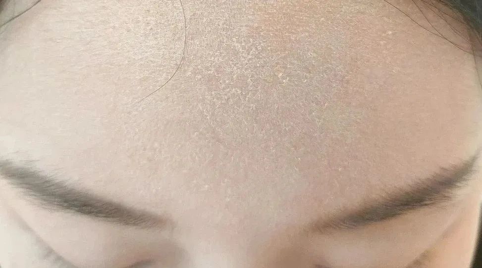 脸上的灰尘,还有化妆,防晒霜等,皮肤会有一点污垢残留,所以可以用洗面