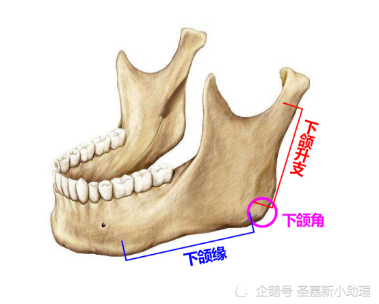 下颌角手术有后遗症吗