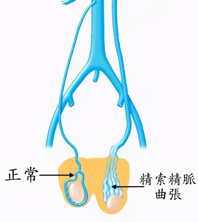 精索静脉走行图片