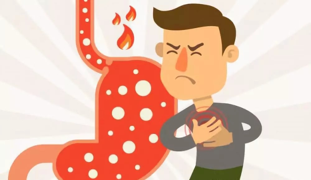 别再误会打嗝了有可能是胃食道逆流惹的祸