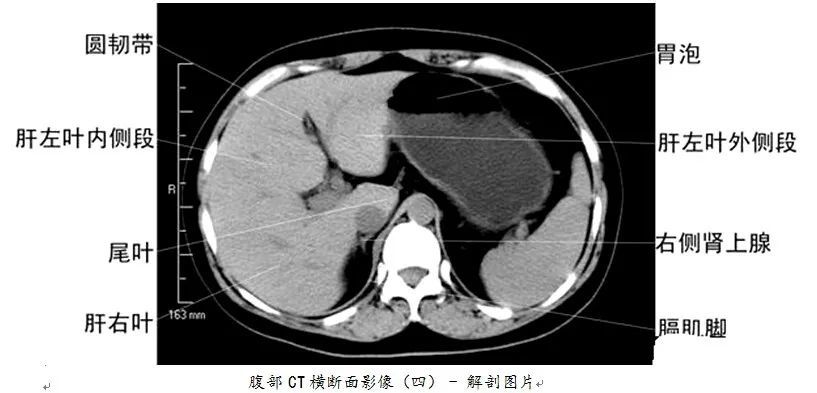 医科普全身ct图谱速收藏