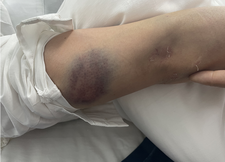 贵阳一女子深夜被男友暴打,男友甚至还举起了菜刀……_腾讯新闻