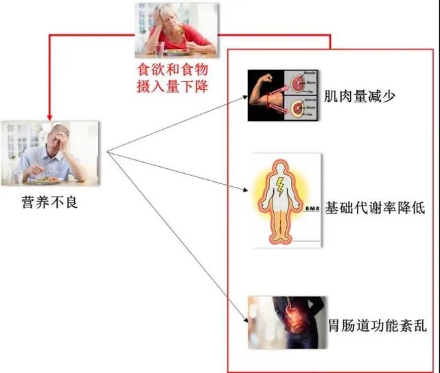 图1 老年人出现营养不良的恶性循环示意图