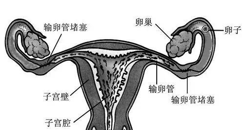 输卵管只剩一侧还能怀孕吗?几率有多大?_腾讯新闻