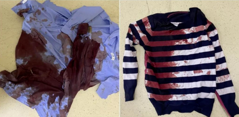 受伤民辅警的血衣